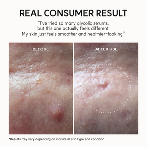 Arencia Eraser Shot Glycolic Acid Booster 30ml - image 7