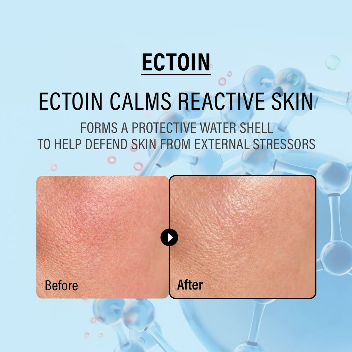 Epii Double Up Cream ECTOIN/PANTHENOL - 50 ml - image 4