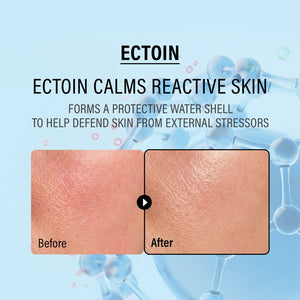 Epii Double Up Cream ECTOIN/PANTHENOL - 50 ml - image 4
