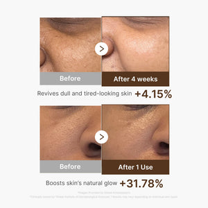 Medicube Deep Vita C Capsule Serum 30ml - image 5