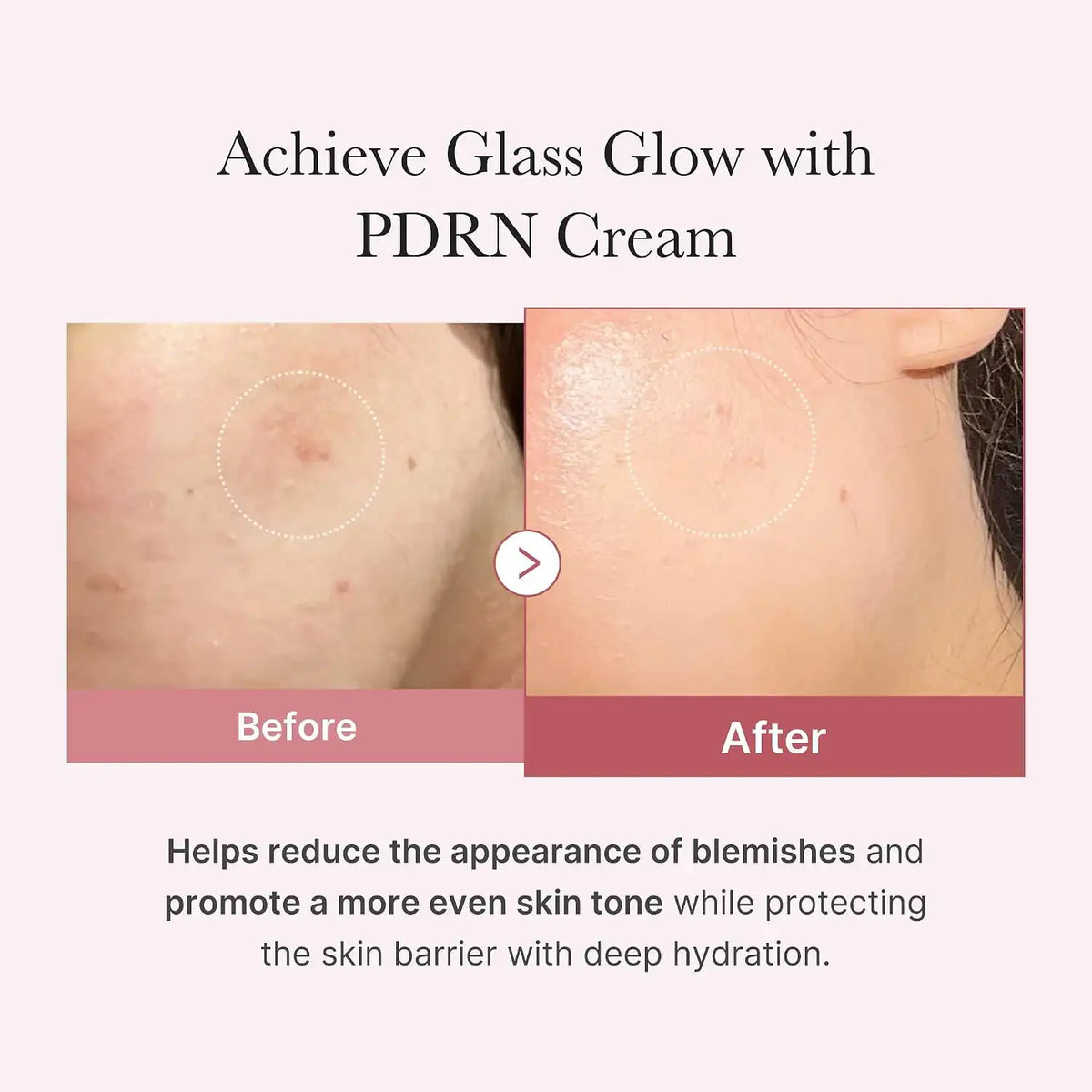 Medicube PDRN Pink Hyaluronic Moisturizing Cream (50ml)