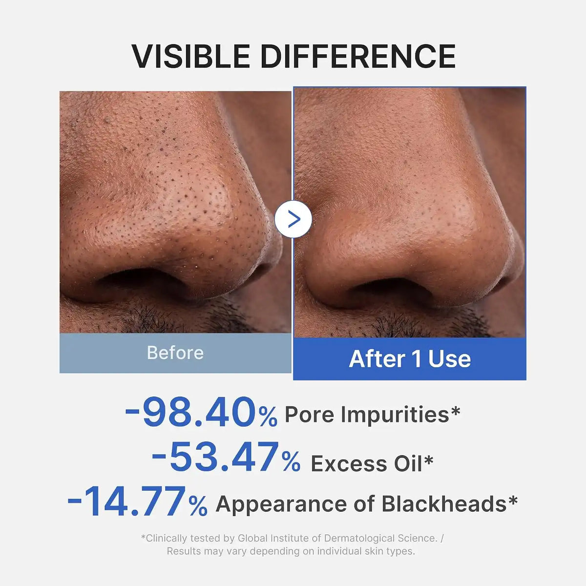 Medicube Zero Pore Blackhead Mud Mask (100g)