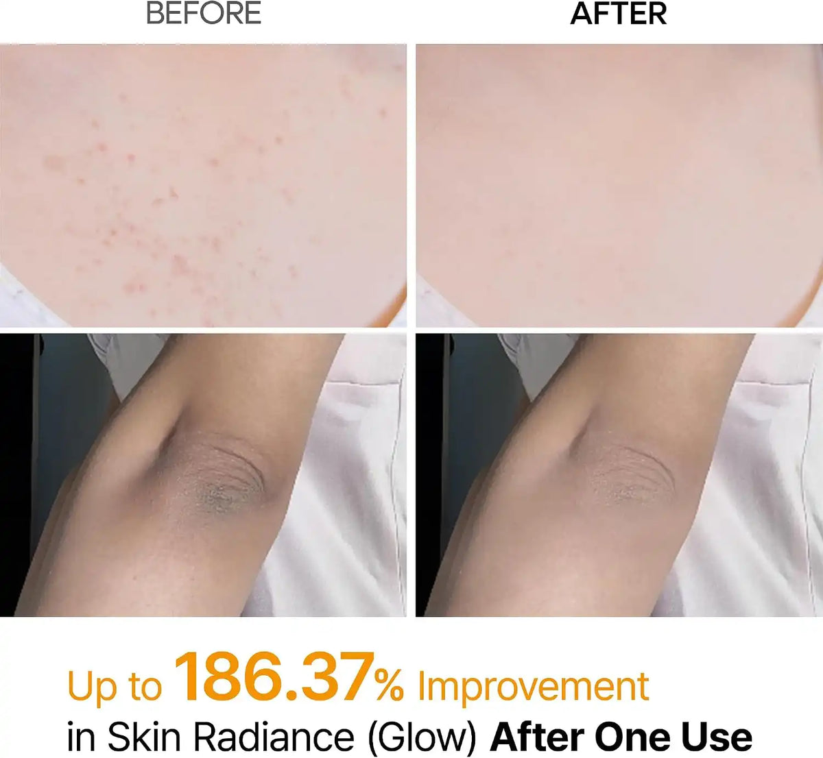 Dr.Melaxin PEEL SHOT EXFOLIATING KOJIC ACID TURMERIC SPRAY (200ml)