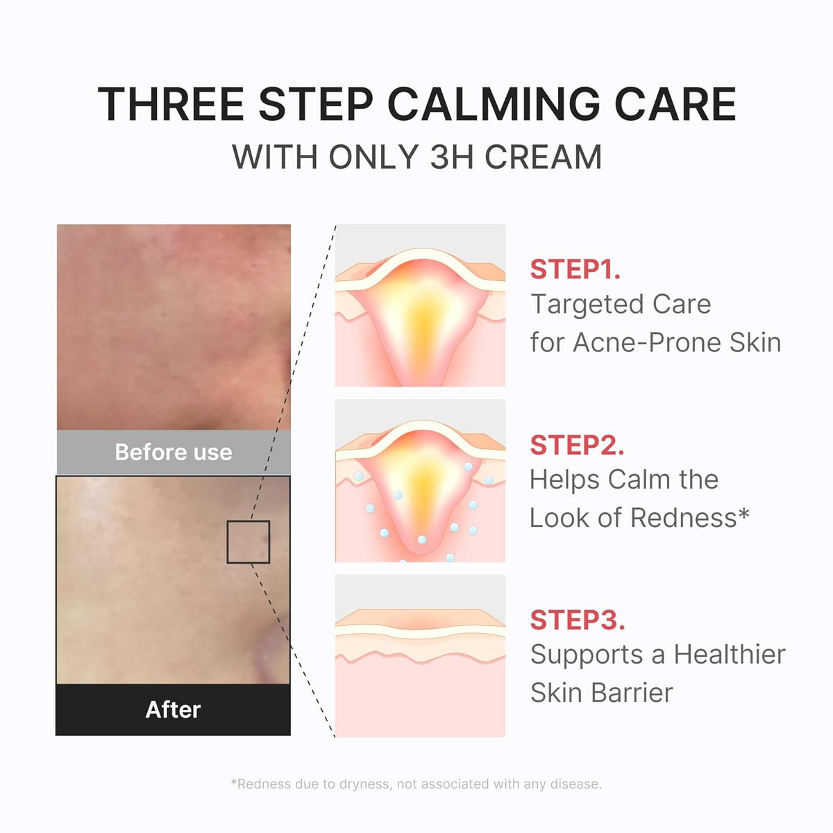 Medicube HYPOCHLOROUS 3H RELIEF CREAM (50ml)