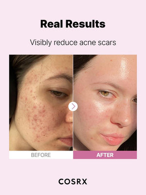 Cosrx The Niacinamide 15 Serum 20Ml - image 8